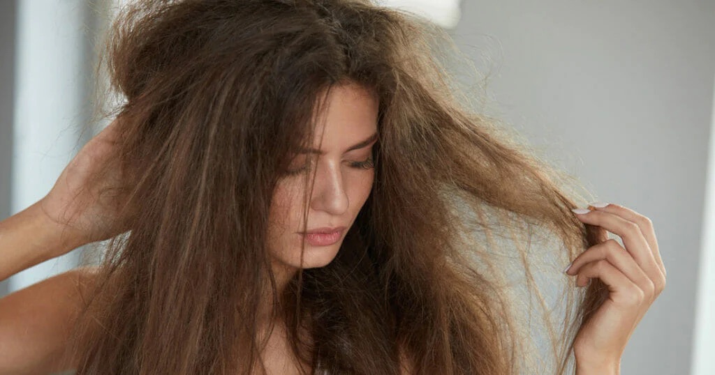 Nguyên nhân gây rụng tóc