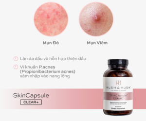 viên uống trị mụn nội tiết