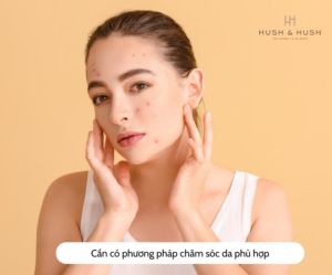 viên uống trị mụn nội tiết