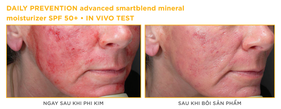 Hiệu quả lâm sàng DAILY PREVENTION