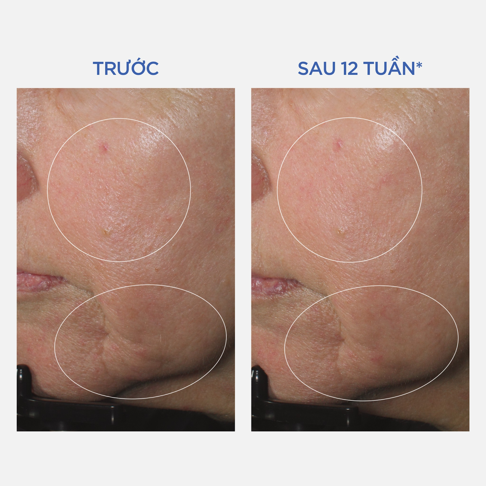 Trước và sau khi dùng Power-C Serum